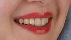 Soñar que pierdes los dientes: el contexto importa